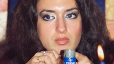 صاحبة أكبر خدود في العالم