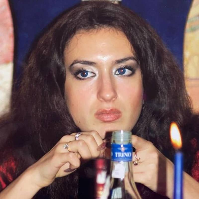 صاحبة أكبر خدود في العالم