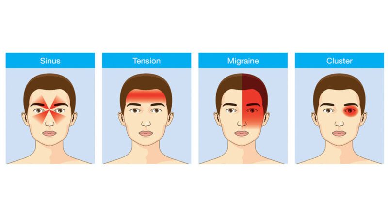 أنواع الصداع