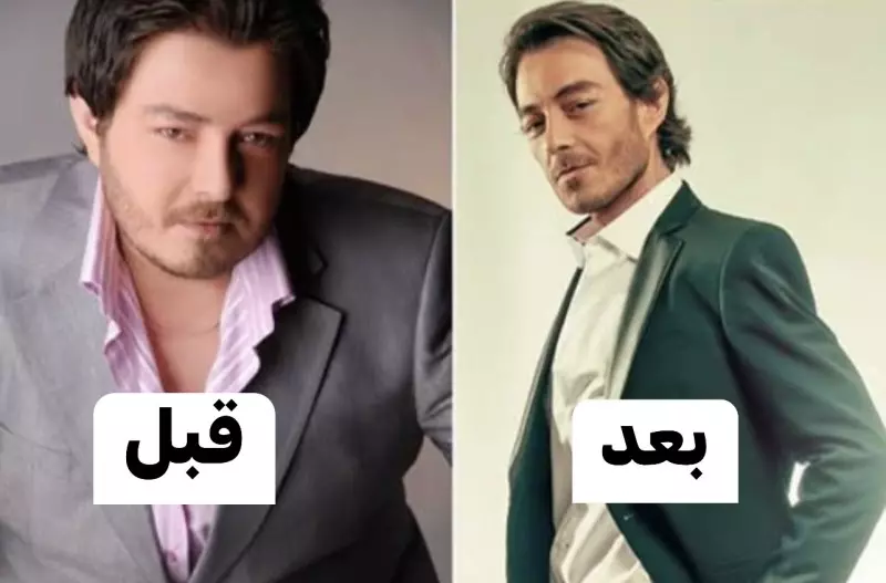 ويزو